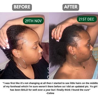 Batana oil customer result